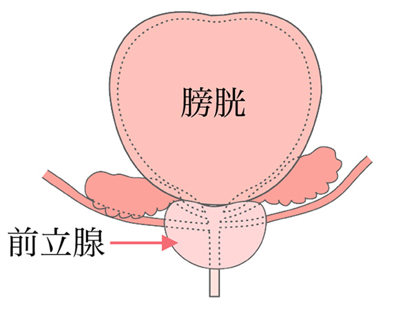 前立腺肥大症のチェックをしてみましょう!